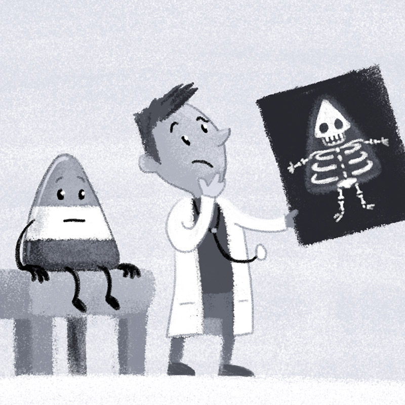 X-Ray